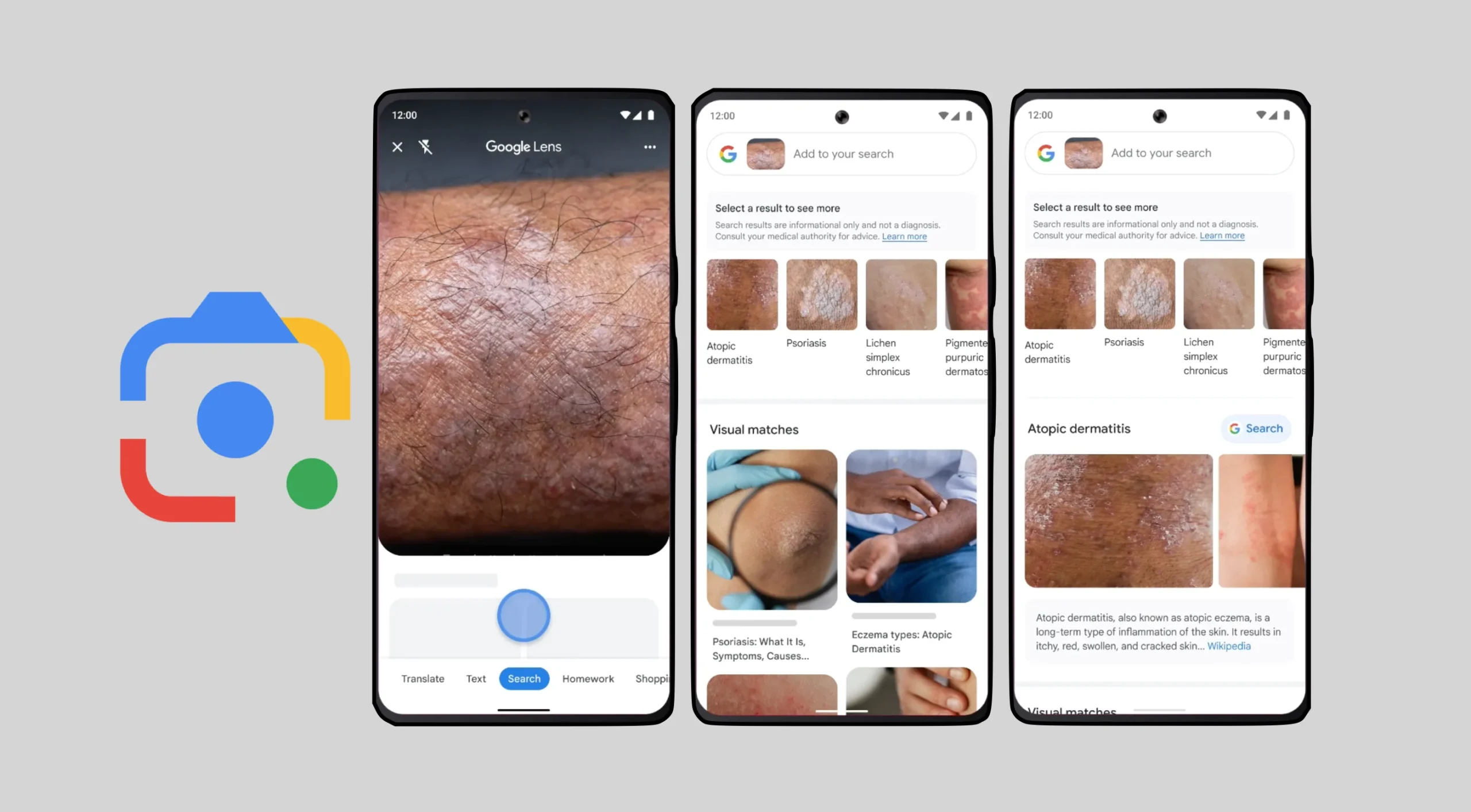 Google lens detects skin problems 2023 update
